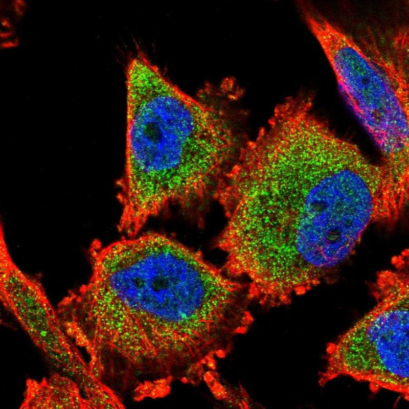 Anti-C14orf159 Antibody