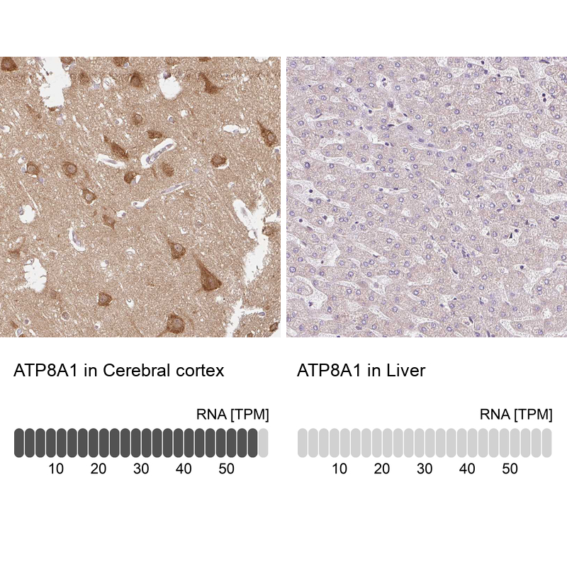 Anti-ATP8A1 Antibody
