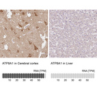 Anti-ATP8A1 Antibody