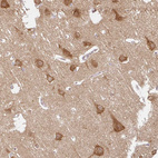 Immunohistochemical staining of human cerebral cortex shows strong membranous and cytoplasmic positivity in neuronal cells.