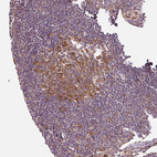Immunohistochemical staining of human lymph node shows moderate membranous positivity in germinal center cells.