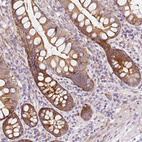 Immunohistochemical staining of human small intestine shows moderate membranous positivity in glandular cells.