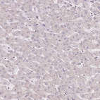 Immunohistochemical staining of human liver shows no positivity in hepatocytes as expected.