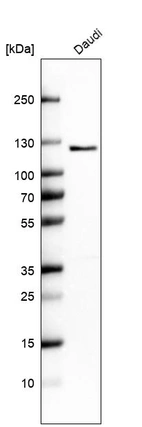 Western blot analysis in human cell line Daudi.