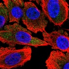 Immunofluorescent staining of human cell line PC-3 shows localization to vesicles.