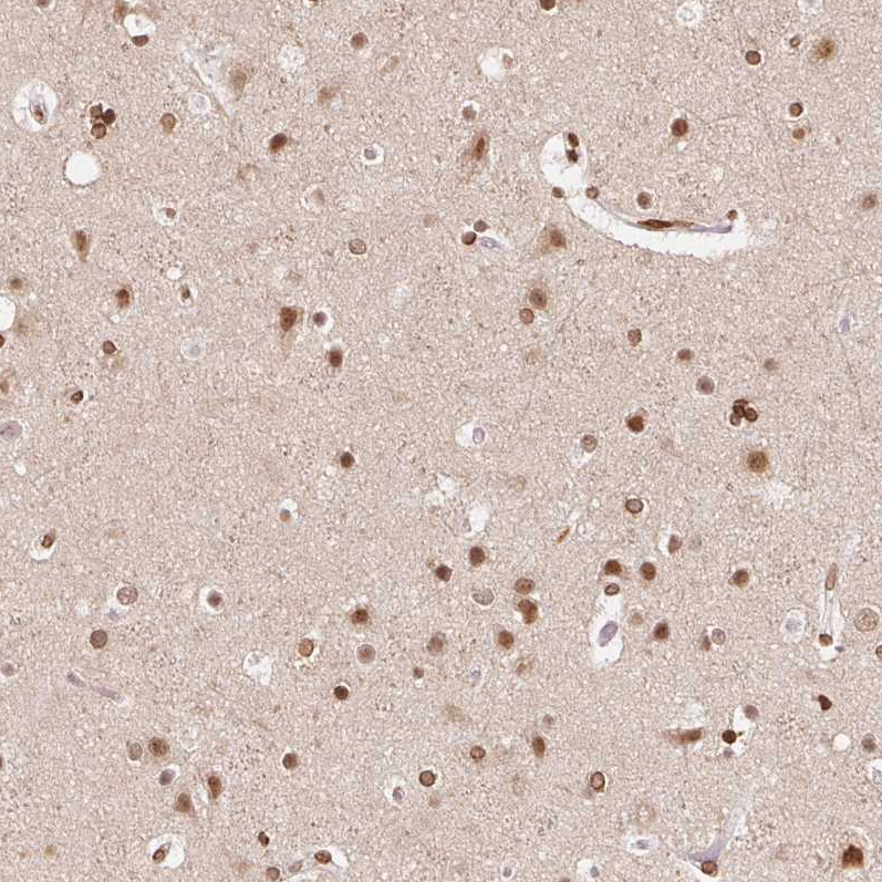 Anti-SAP30BP Antibody