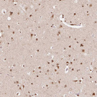 Anti-SAP30BP Antibody