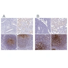 Immunohistochemical staining of human endometrium, kidney, lymph node and tonsil using Anti-CR2 antibody HPA052942 (A) shows similar protein distribution across tissues to independent antibody HPA060715 (B).