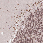 Immunohistochemical staining of human cerebellum shows moderate nuclear positivity in Purkinje cells and molecular layers cells with additional nuclear membranous positivity.
