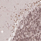 Immunohistochemical staining of human cerebellum shows moderate nuclear positivity in Purkinje cells and molecular layers cells with additional nuclear membranous positivity.