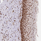 Immunohistochemical staining of human cervix shows strong nuclear positivity in squamous epithelial cells.