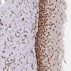 Immunohistochemical staining of human cervix shows strong nuclear positivity in squamous epithelial cells.