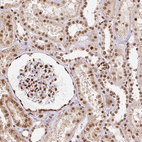 Immunohistochemical staining of human kidney shows strong nuclear positivity in cells in glomeruli and moderate nuclear positivity in cells in tubules.