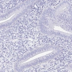 Immunohistochemical staining of human endometrium shows no positivity in glandular cells as expected.