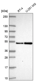 Western blot analysis in human cell line RT-4 and human cell line U-251 MG.