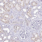 Immunohistochemical staining of human kidney shows very weak membranous positivity in cells in tubules as expected.