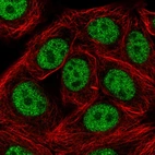 Immunofluorescent staining of human cell line MCF7 shows localization to nucleoplasm.