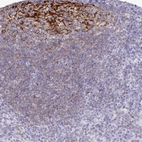 Immunohistochemical staining of human tonsil shows strong membranous positivity in germinal center cells.