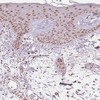 Anti-THOC6 Antibody