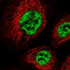 Immunofluorescent staining of human cell line A-431 shows localization to nuclear speckles.