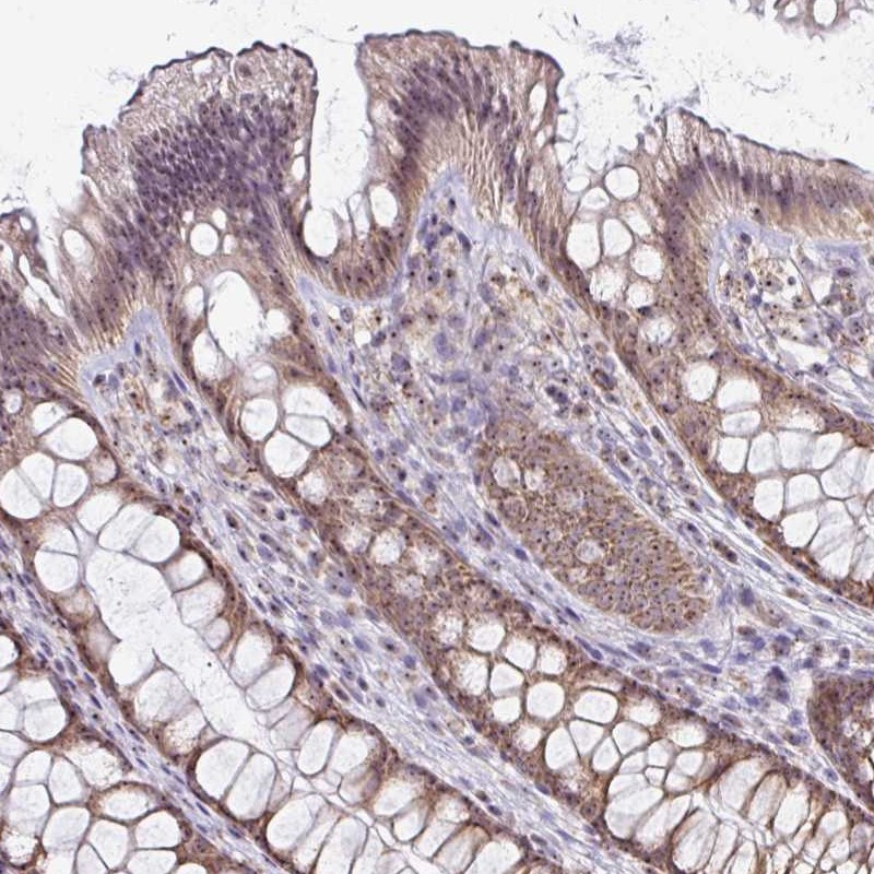 Anti-NACC2 Antibody