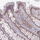 Anti-NACC2 Antibody
