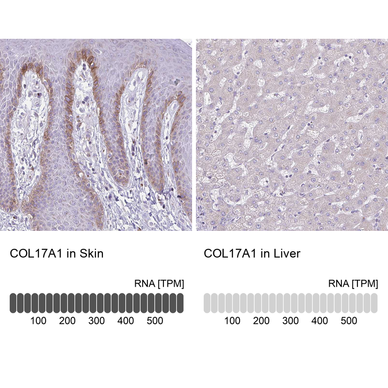 Anti-COL17A1 Antibody