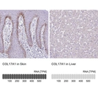 Anti-COL17A1 Antibody