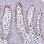 Immunohistochemical staining of human Skin shows weak granular cytoplasmic positivity in squamous epithelial cells.