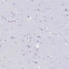 Immunohistochemical staining of human Cerebral cortex shows no positivity in neuronal cells as expected.