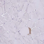 Immunohistochemical staining of human Skeletal muscle shows no positivity in myocytes as expected.