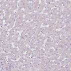 Immunohistochemical staining of human Liver shows no positivity in hepatocytes as expected.