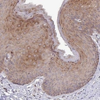 Anti-TNFSF12 Antibody