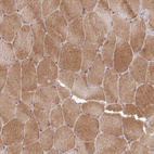 Immunohistochemical staining of human skeletal muscle shows strong cytoplasmic positivity in myocytes.