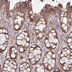 Immunohistochemical staining of human rectum shows strong cytoplasmic positivity in glandular cells.