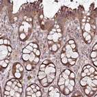 Immunohistochemical staining of human rectum shows strong cytoplasmic positivity in glandular cells.