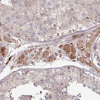Immunohistochemical staining of human testis shows strong cytoplasmic positivity in Leydig cells.