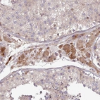 Immunohistochemical staining of human testis shows strong cytoplasmic positivity in Leydig cells.