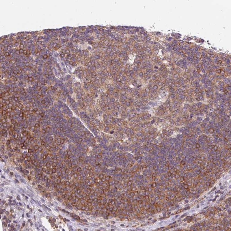 Anti-CARD11 Antibody