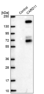 Western blot analysis in control (vector only transfected HEK293T lysate) and CARD11 over-expression lysate (Co-expressed with a C-terminal myc-DDK tag (~3.1 kDa) in mammalian HEK293T cells, LY403162).