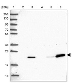 Lane 1: Marker [kDa] 250, 130, 95, 72, 55, 36, 28, 17, 10_br/_Lane 2: Human cell line RT-4_br/_Lane 3: Human cell line U-251MG sp_br/_Lane 4: Human plasma (IgG/HSA depleted)_br/_Lane 5: Human liver tissue_br/_Lane 6: Human tonsil tissue