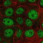 Immunofluorescent staining of human cell line MCF7 shows localization to nucleoplasm.