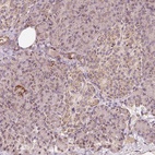 Anti-ZNF460 Antibody