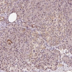 Anti-ZNF460 Antibody