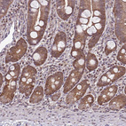 Immunohistochemical staining of human small intestine shows strong cytoplasmic positivity in glandular cells.