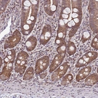 Immunohistochemical staining of human small intestine shows strong cytoplasmic positivity in glandular cells.