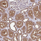 Immunohistochemical staining of human kidney shows strong cytoplasmic positivity in cells in tubules.