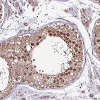 Immunohistochemical staining of human testis shows moderate to strong nuclear and cytoplasmic positivity in cells in seminiferous ducts.