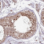 Immunohistochemical staining of human testis shows moderate to strong nuclear and cytoplasmic positivity in cells in seminiferous ducts.