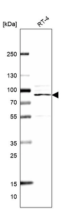 Western blot analysis in human cell line RT-4.